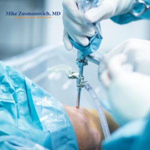Arthroscopic Surgery